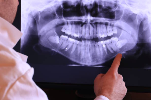Best Emergency Treatment for Jaw Pain or Injury in Riverbank, CA